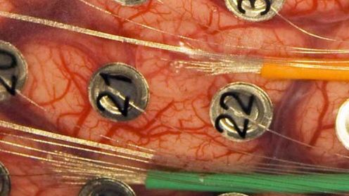 Naukowcy wynaleźli efektywniejszy sposób odczytywania ludzkich myśli 1