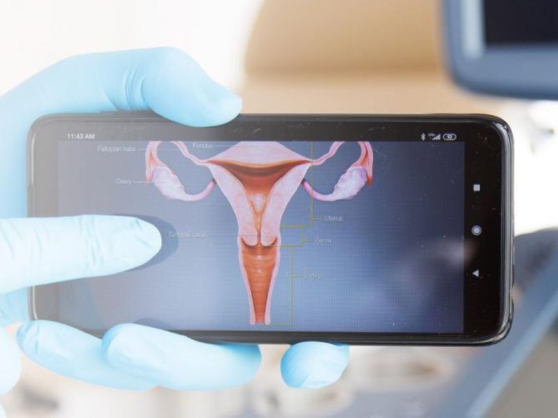 Bezpłatne badania w kierunku HPV na NFZ. Mogą skorzystać mieszkanki Torunia