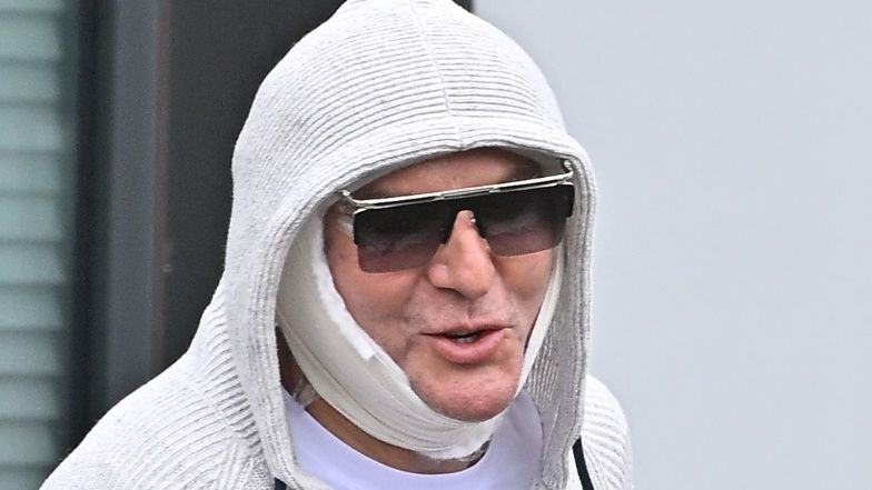 Krzysztof Gojdź po liftingu twarzy