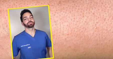 Czym są czerwone guzy na skórze? Znany dermatolog zabrał głos