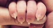 Długie paznokcie u noworodka. Niezwykłe zdjęcie poruszyło internautów