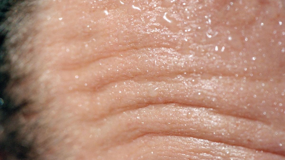 Pocenie się jest jednym z kluczowych mechanizmów termoregulacji.