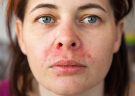 Gronkowiec w nosie – objawy, rozpoznanie i leczenie