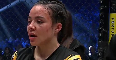 Pokazała twarz po walce na Clout MMA 4. Straciła sporo zdrowia