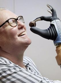 Pierwsza bioniczna kobieta. Ma rękę robota sterowaną mózgiem