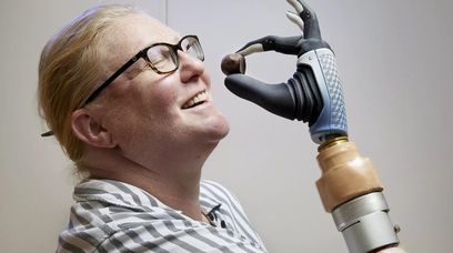 Pierwsza bioniczna kobieta. Ma rękę robota sterowaną mózgiem