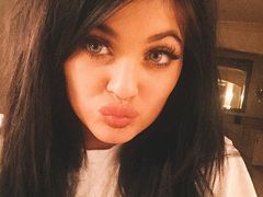 Chcą mieć usta jak Kylie Jenner, ale efekty są katastrofalne