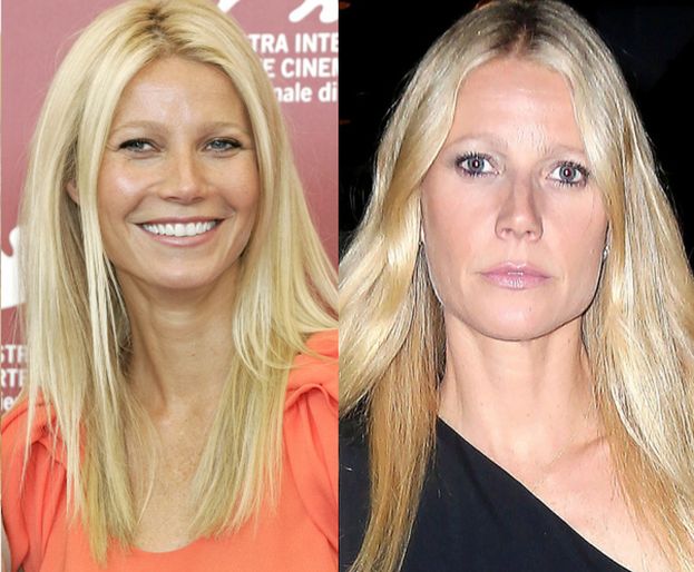 43-letnia Gwyneth Paltrow "wypełniła usta" i "wygładziła zmarszczki"? (ZDJĘCIA)