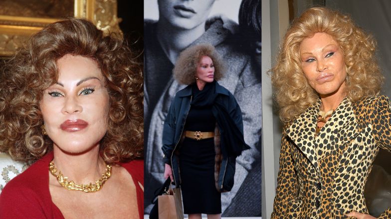 Jocelyn Wildenstein z blond piękności przemieniła się w najsłynniejszą "Kobietę Kota". Tak wyglądała PRZED OPERACJAMI (DUŻO ZDJĘĆ)