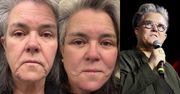 Z rzeczy ważnych: Rosie O'Donnell zrobiła sobie LIFTING TWARZY. Martwiła się, że to "zdrada feminizmu", ale już jej przeszło: "Przed i po"