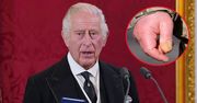 Karol III ma "kiełbasiane" palce. Brytyjczycy boją się o króla, lekarz zabiera głos