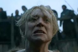 "Gra o tron": Oto najbrzydsza kobieta telewizji? Biorą ją za faceta