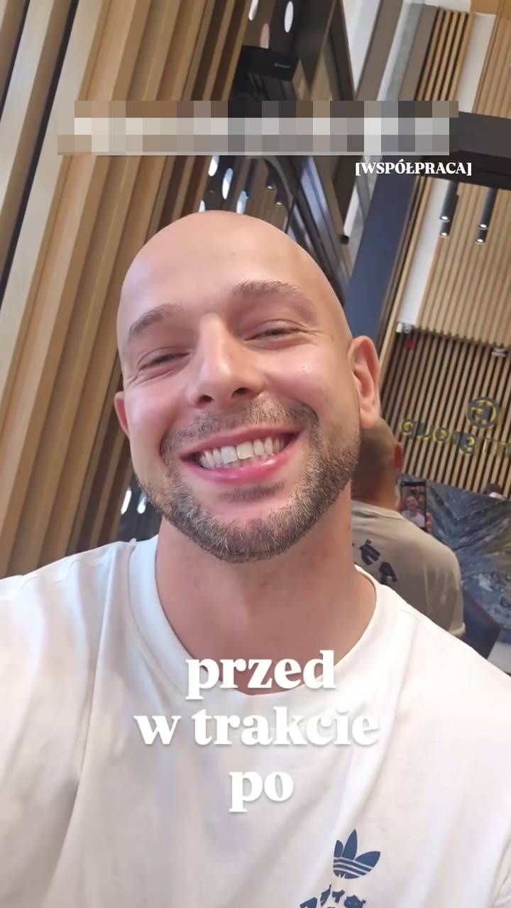 Maciej Pela poleciał do Turcji po nowy uśmiech