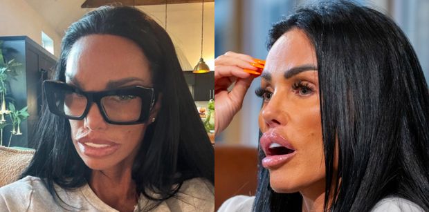 Katie Price prezentuje swoje stuningowane oblicze: "Trudno mi uwierzyć, że to jest JEJ PRAWDZIWA twarz" (FOTO)