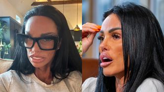 Katie Price prezentuje swoje stuningowane oblicze: "Trudno mi uwierzyć, że to jest JEJ PRAWDZIWA twarz" (FOTO)