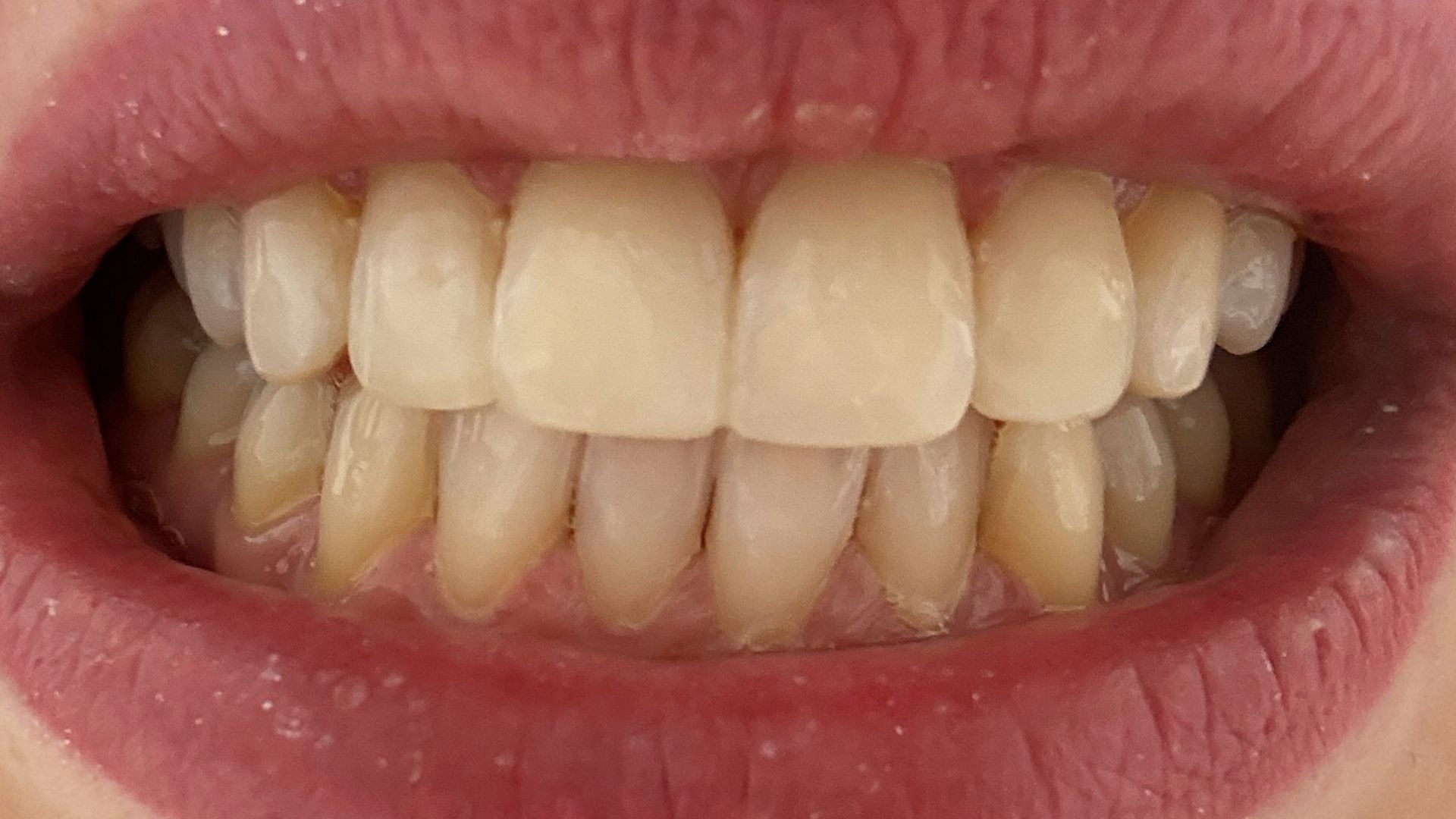 Zdrowie zębów to nie tylko kwestia estetyki, ale klucz do prawidłowego funkcjonowania całego organizmu.