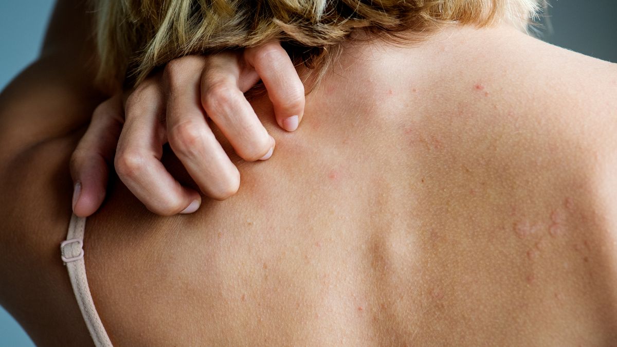 Jakie objawy daje rak wątroby?