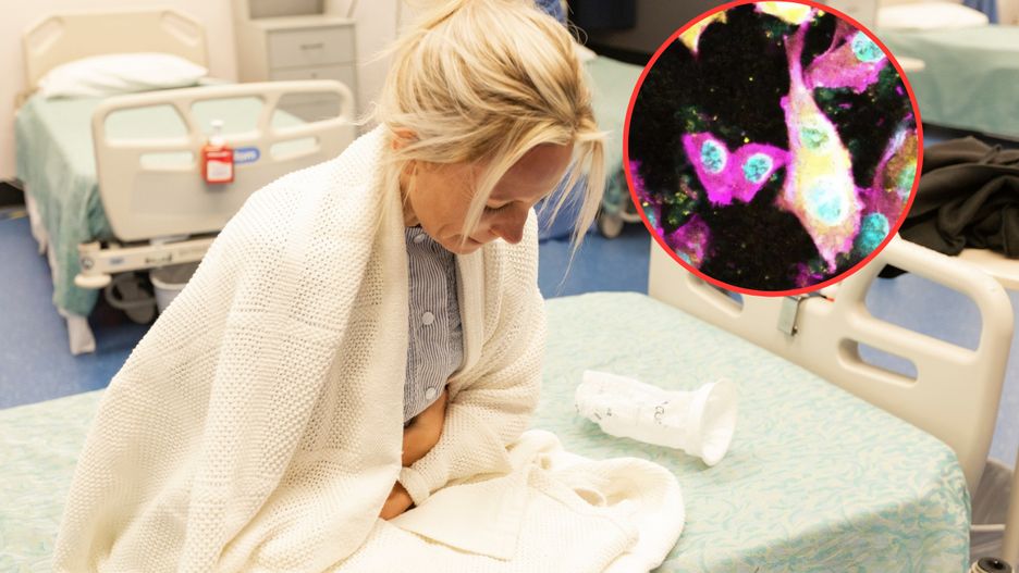 Naukowcy odkryli toksynę wytwarzaną przez bakterie E.coli