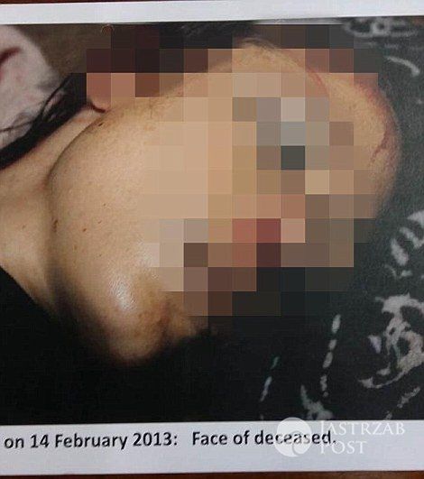 Zdjęcia ciała dziewczyny Oscara Pistoriusa