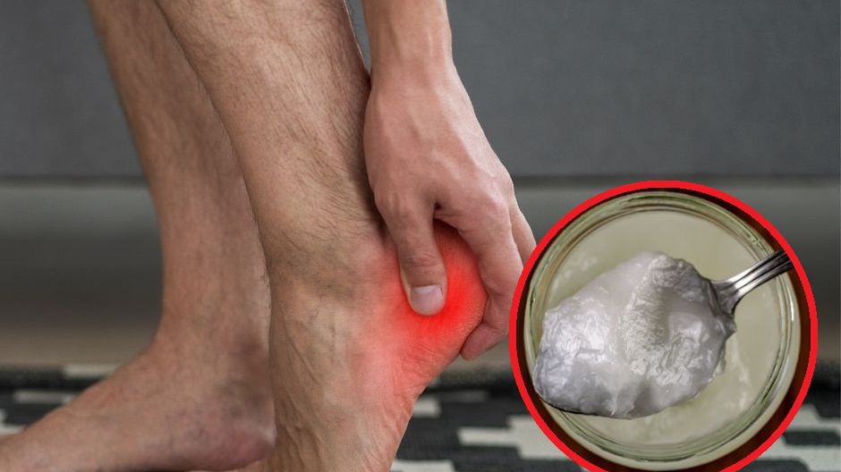 Jak pozbyć się ostrogi piętowej? Wypróbuj naturalną miksturę