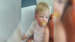 Dziecko poparzone wodą z węża ogrodowego 