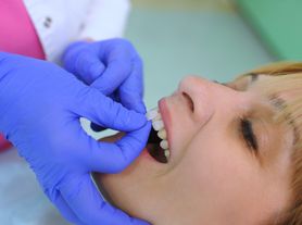Czy licówki niszczą zęby? Kiedy warto się na nie zdecydować?	