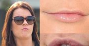 Co stało się z ustami Agnieszki Radwańskiej? "Wygląda koszmarnie"