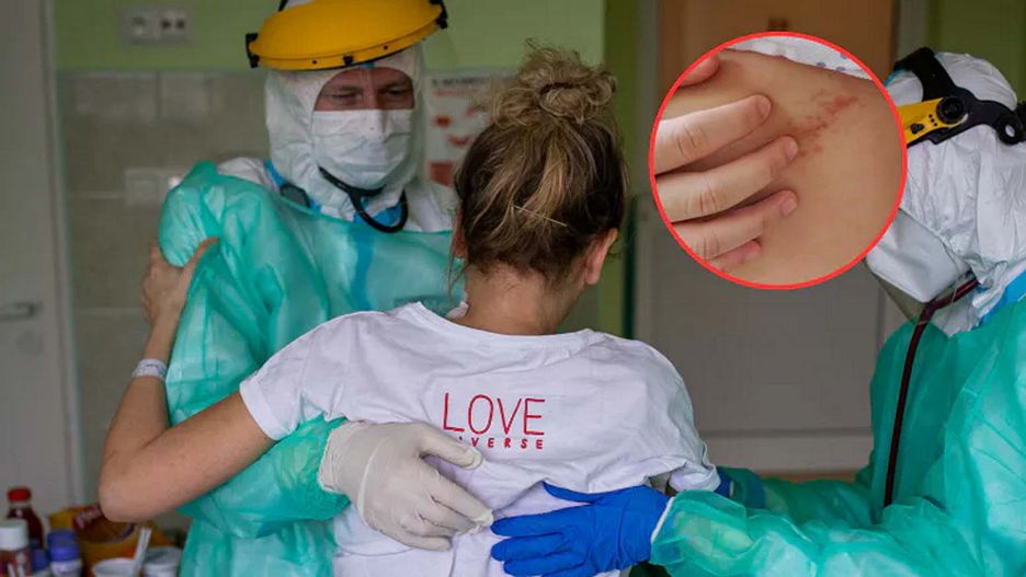 Zapomniana choroba atakuje Polaków. "Obserwujemy lawinowy wzrost zachorowań"