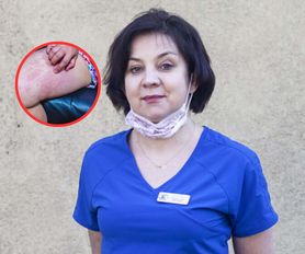 Coraz więcej przypadków odry. Lekarka wskazuje trzy miasta, w których jest najgorzej