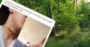 Wjechał do lasu jednośladem. Mógł stracić życie przez linkę między drzewami