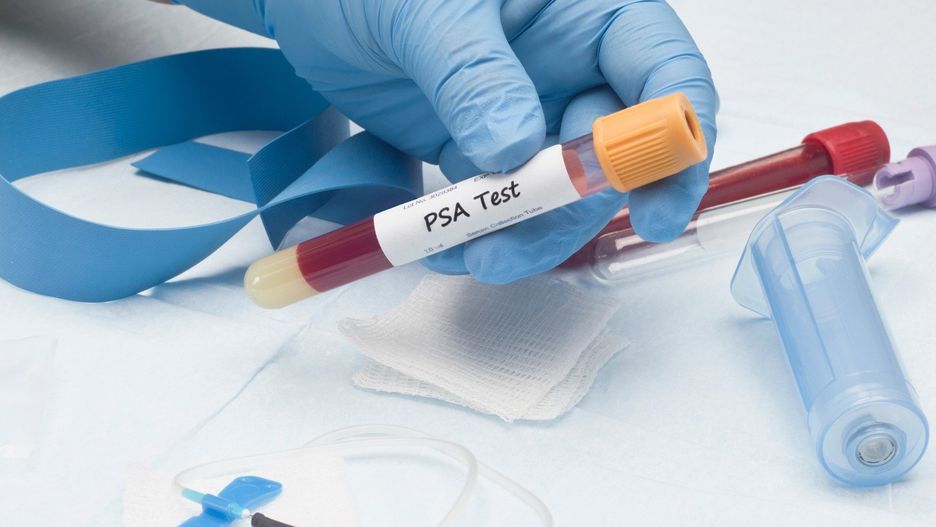 Czym jest badanie PSA i co warto o nim wiedzieć?