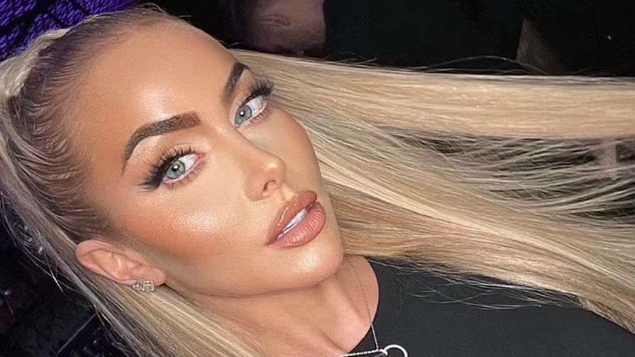 34-latka ostrzega przed konsekwencjami stosowania wypełniaczy