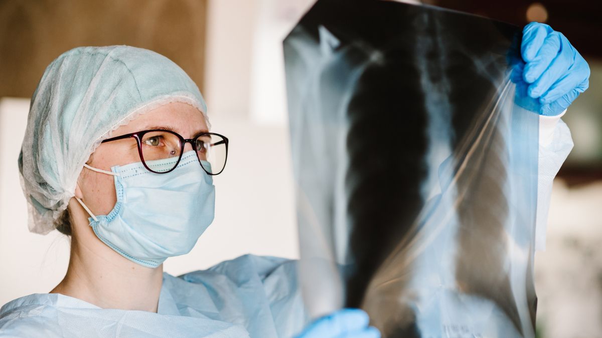 Tomografia płuc jest badaniem zalecanym nałogowym palaczom