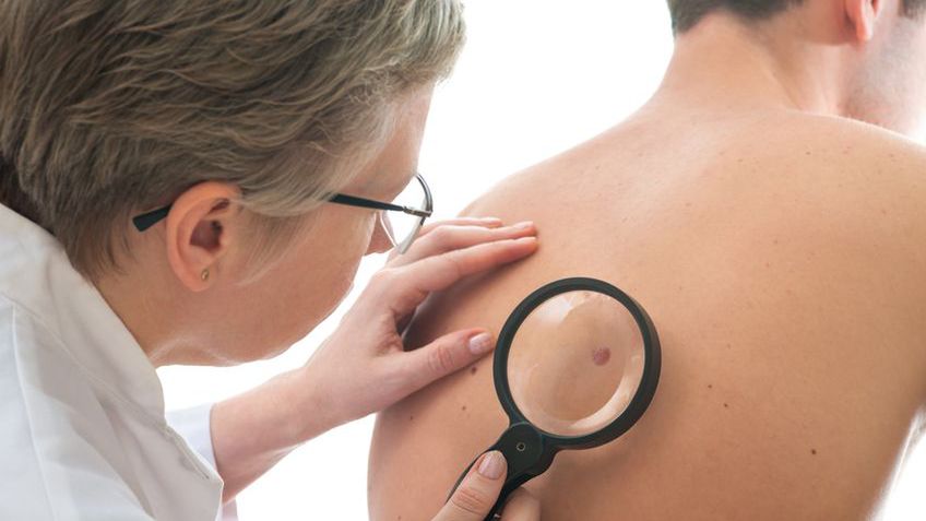 6 zaskakujących czynników, powodujących raka skóry