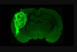 Miniaturowe ludzkie mózgi wszczepione szczurom