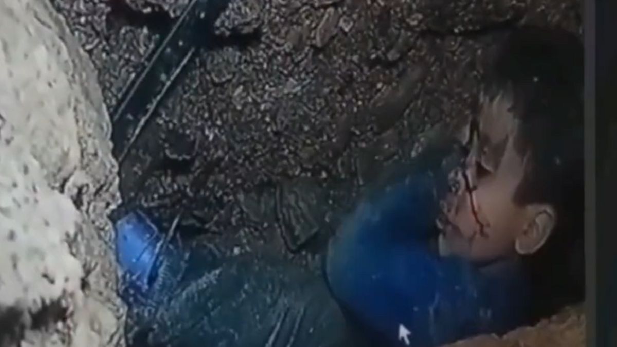 5-latek utknął w studni.