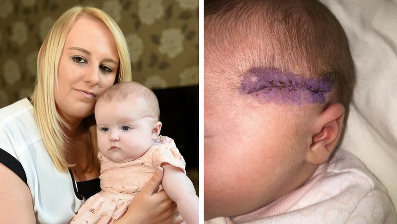 Podczas cesarskiego cięcia rozcięli głowę jej dziecku. Lekarz: "To pani wina!"