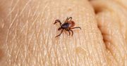 Rozpoczyna się sezon na kleszcze. Jak bezpiecznie go usunąć?