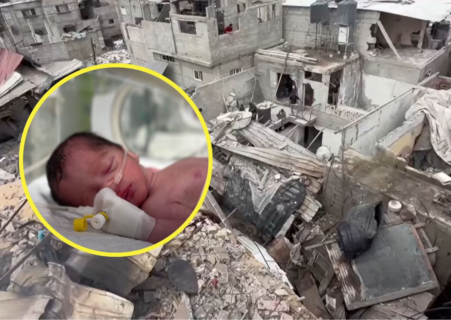 Strefa Gazy: noworodek uratowany z łona zmarłej matki