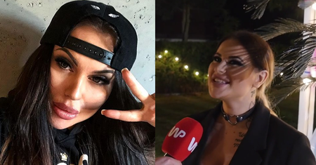 Ewelona nie weźmie udziału w FAME MMA przez wypełniacze w twarzy?