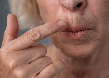 Perełka z apteki za grosze. Mówi się o niej "złoto Madagaskaru"