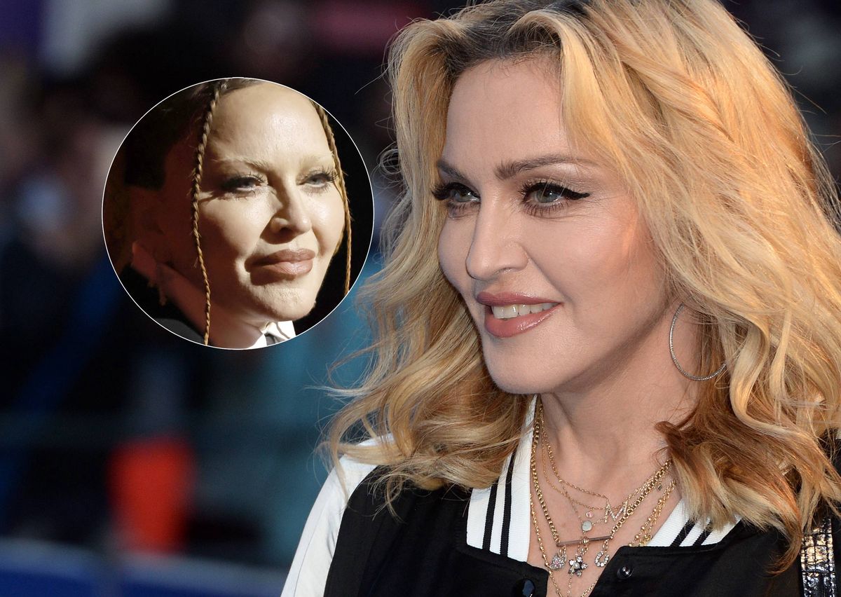 Madonna nagminnie korzysta z medycyny estetycznej