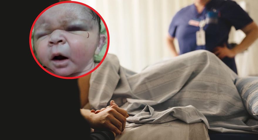 Myśleli, że dziecko urodzi się martwe. "Po porodzie zaczęło oddychać"