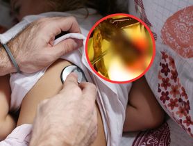 4-latkę bolał brzuch. Szokujące, co znaleźli w jej żołądku