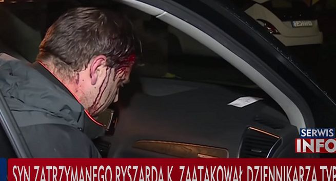 Sąd w Gdyni umorzył postępowanie karne wobec syna biznesmena ws. ataku na pracowników TVP