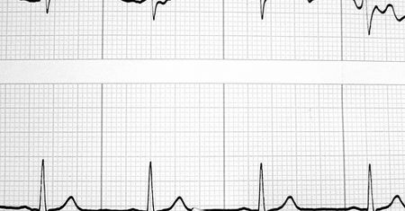 Debiut Medicalgorithmics na GPW. Akcja już za 275 złotych