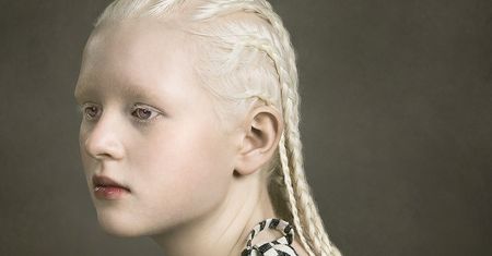 Justine Tjallinks opowiada historię albinizmu w swoim projekcie „Jeweled”
