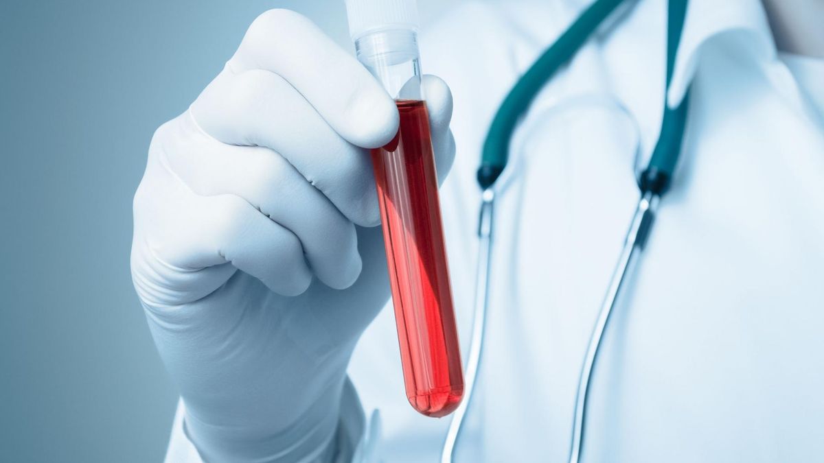 Badanie MCHC wykonywane jest w przebiegu całkowitego badania morfologicznego krwi