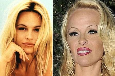 "Słoneczny patrol": Nowa twarz Pameli Anderson