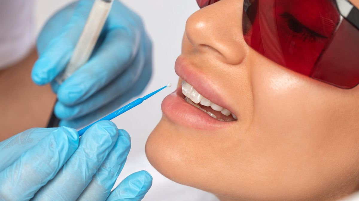 Lakierowanie zębów to nakładanie specjalnego lakieru fluorowego na powierzchnie wszystkich zębów.